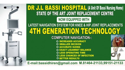 Total Knee Replacement With Navigation