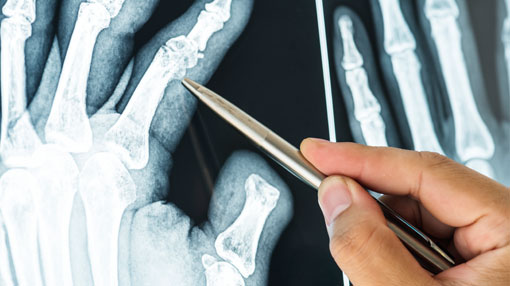 Orthopaedics & Trauma Injury